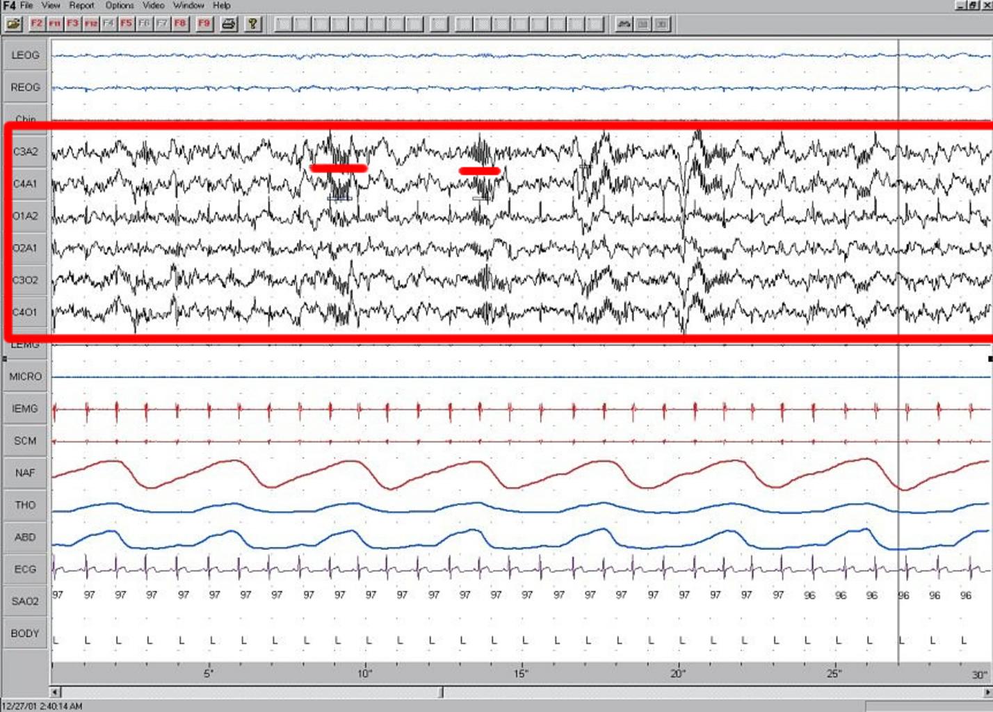 Raw EEG waves