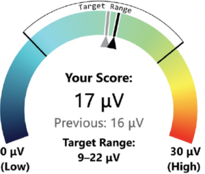 Brain Reaction Voltage