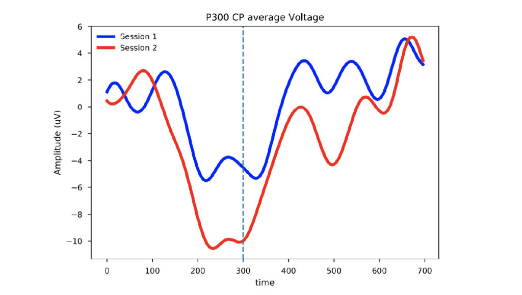 Pre and Post ERP Averages P300 latency (response timing) measured across age groups, showing changes from early adulthood through later life. The trend illustrates gradual differences in EEG-derived response timing over time, based on reference population data.