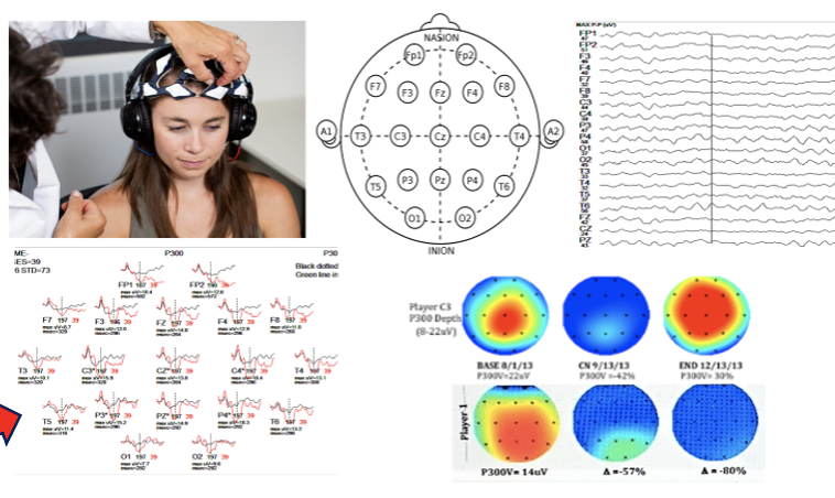P300 latency (response timing) measured across age groups, showing changes from early adulthood through later life. The trend illustrates gradual differences in EEG-derived response timing over time, based on reference population data.