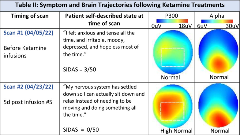 Symptom and Brain Trajectories P300 latency (response timing) measured across age groups, showing changes from early adulthood through later life. The trend illustrates gradual differences in EEG-derived response timing over time, based on reference population data.